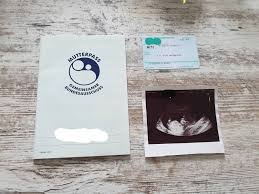 Wann bekommt man den mutterpass? Welche Untersuchungen Sind Notwendig Apotheke Adhoc