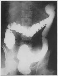 Https Jamanetwork Com Data Journals Surg 13719 Archsurg 15 4 005 Pdf