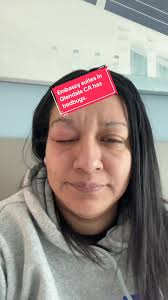 Embassy Suites by Hilton Glendale