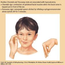 It is obtained by striking with a finger or a hammer a point that is approximately 2 cm in front of the lobe of the ear and about 1 cm below the zygomatic process. R N A Patient Is Hypocalcemic When Total Serum Calcium