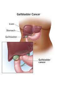 Image result for Gall Bladder