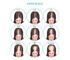 Thankfully, dht does not lead to the same type of extreme hair loss experienced in men. Female Pattern Hair Loss Lifestyle Pharmacy