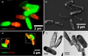 Maybe you would like to learn more about one of these? Single Cell Resolution Of Uncultured Magnetotactic Bacteria Via Fluorescence Coupled Electron Microscopy Applied And Environmental Microbiology