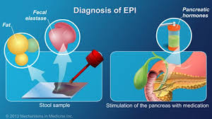 Pin On Gastrointestinal
