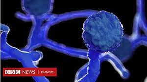 Jun 08, 2021 · gregorio avendaño jiménez, primer paciente sospecho de hongo negro en méxico, murió este lunes debido a las complicaciones de la enfermedad, según sus familiares.el hombre, de 34 años, fue. Hongo Negro Detectan Un Caso De Mucormicosis En Alguien Infectado Con Covid 19 En Uruguay Bbc News Mundo