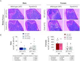 Maybe you would like to learn more about one of these? Plos One Trpm8 Modulates Temperature Regulation In A Sex Dependent Manner Without Affecting Cold Induced Bone Loss