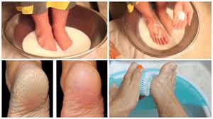 Non Spendere Soldi Per La Pedicure Come Avere Dei Piedi Splendidi Con Questi 2 Ingredienti Da Cucina Pedicure Fai Da Te Pedicure Trattamento Piedi