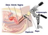 Blog Del Centro Clinico Betanzos 60 Sangrado Vaginal Tras El Coito