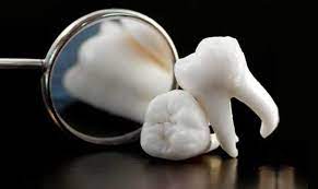 Does Orajel Work On A Painful Wisdom Tooth Best Dental