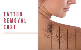 In most places you can expect to pay between $900 to $3,500 for complete laser tattoo removal. Tattoo Removal Cost In Delhi Desmoderm