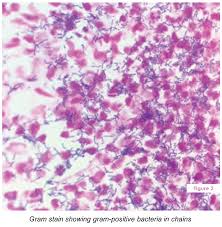 In a recent study in ibadan, listeria spp. An Unexpected Meningitis Culprit