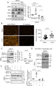 Carbon monoxide detectors save lives, but neither state and federal laws don't mandate them in some private and public housing. Claudin 2 Suppresses Gef H1 Rhoa And Mrtf Thereby Impacting Proliferation And Profibrotic Phenotype Of Tubular Cells Journal Of Biological Chemistry
