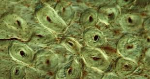 The large dark spots are passages for blood vessels and nerves. Cross Section Decalcified Bone Microscope Video By C Dr Lange Unitybox De Stock Footage 394854758