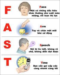 Đột ngột không nói được. LÆ°u Y Nháº¥t Ä'á»‹nh Pháº£i Nhá»› Khi SÆ¡ Cá»©u Táº¡i Chá»— NgÆ°á»i Bá»‹ Ä'á»™t Quá»µ Vinmec