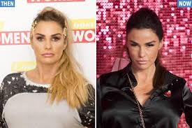 Katrina amy alexandra alexis price, known previously by the pseudonym jordan, is an english media personality, model and businesswoman. Katie Price Looks Dramatically Different After Jaunt To Cosmetic Surgery Clinic In Turkey For New Teeth