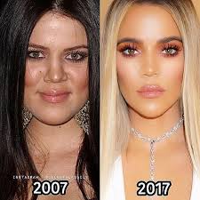 See her evolution up to 2021 Before And After Kardashian Plastic Surgery Khloe Kardashian Plastic Surgery Plastic Surgery