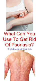 Psoriasisremedies Australian Gold Body Lotion For Psoriasis Prednisone For Psoriasis Typesofpso Swollen Feet Remedy Foot Remedies Plaque Psoriasis Treatment