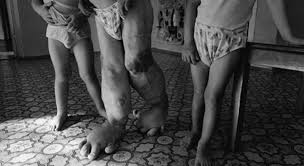 International nuclear information system (inis). Chernobyl The Worst Nuclear Disaster Of All Time Sick Chirpse