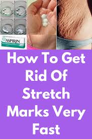 Bio Oil White Stretch Marks Before And After How To Get Rid Of Stretch Marks Very Fast Remedy 1 Just Take Juice Of Half Lemon Apply Lemon Juice On St Stretch Marks Bio Oil Stretch Marks Natural Body Oils