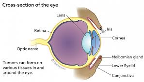 Cutaneous mast cell tumor has medium discrete. Eyelid Conjunctival And Peri Ocular Tumors Vca Animal Hospital