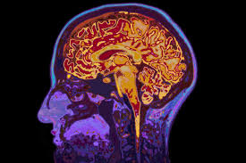 Thanks To Science You Can Soon Wipe Out Your Worst Memories Brain Scan Dementia Brain Injury