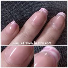 El buque cumple una función específica (buque de guerra, buque hospital, buque mercante, buque de transporte, etc.) Crecimiento Francesa Esmaltado Permanente Dos Semanas Despues