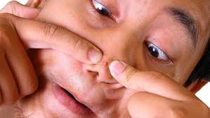 Sabun cuci muka ini memiliki formula dan tekstur yang ringan yang akan membantu membersihkan wajah kita dari segala macam bentuk kotoran dan juga. Letak Jerawat Di Wajah Dan Kaitannya Dengan Masalah Kesehatan 2