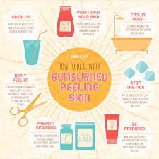 Visit insider's health reference library for more advice. 6 Tips For Dealing With Sunburned Peeling Skin Sheknows