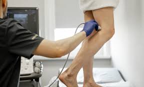 The Ultimate Guide to Vein Treatment Recovery: What to Expect and How to  Heal