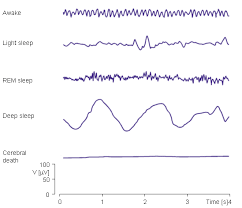 Magnify Rem Sleep Levels Of Consciousness Deep Sleep
