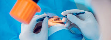 Maybe you would like to learn more about one of these? Cataracta Ce Este Tratament OperaÈ›ie Opticlinicmed Ro