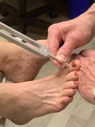 Image result for Tuning Fork Test