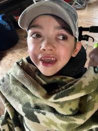 We don't like our braces but they work wonders!