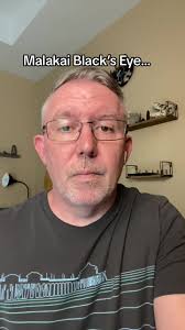 How Did Akil Mitchell Eyes Pop Out