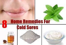 Home Remedy For Cold Sores Cold Home Remedies Cold Sores Remedies Cold Sore Treatment