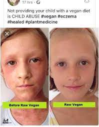 Apple cider vinegar has antibacterial properties, so you can use it to clean everything from your kitchen counter to the bathtub. Get This Child Some Apple Cider Vinegar Insanepeoplefacebook