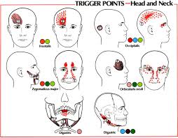 Trigger Point Referral Patterns Balance In Motion Bodywork