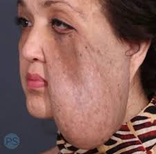 Dora Caro @bellezacolombianaspaplano stands as a beacon of excellence in  the realm of personal care and wellness. With a steadfast commitment to  providing unparalleled service, Dora Caro Spa delivers transformative  experiences that