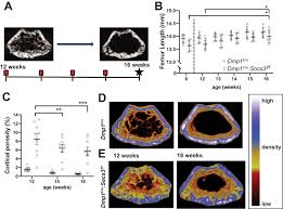 Compact bone forms the outer layer of all bones and most of the structure of long bones see diagram right. Cortical Bone Maturation In Mice Requires Socs3 Suppression Of Gp130 Stat3 Signalling In Osteocytes Elife