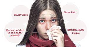 What Is Nasal Congestion? | Words Of Wisdom | Buckley's