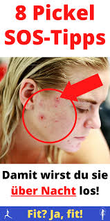 Also ich bin 14 und hab halt viele pickel so halt kleine und so auf meiner stirn und wangen und ich habe schon viel versucht aber es hilft irgendwie alles. Pickel Schnell Loswerden 8 Sehr Hilfreiche Tipps Pickel Im Gesicht Haut Tipps Tipps Gegen Pickel