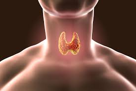 Quelle différence entre hyperthyroïdie et hypothyroïdie ? Hypothyroidie Certaines Personnes Pourraient Etre Diagnostiquees A Tort