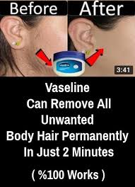 In 2 Minutes Remove All Body Unwanted Hair Permanently At Home With Vaseline Slideten Unwanted Hair Permanently Unwanted Hair Unwanted Hair Removal