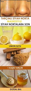 Tarcinli Siyah Nokta Maskesi Www Vipbakim Com Siyah Noktalar Saglikli Beslenme
