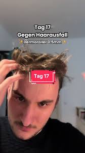 Derma Roller Rossman