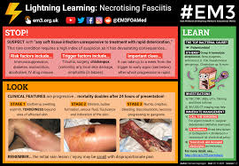 The bodily waste expelled by an #ostomy through the stoma is commonly referred to as the stomal output. Lightning Learning Necrotising Fasciitis Em3 East Midlands Emergency Medicine Educational Media