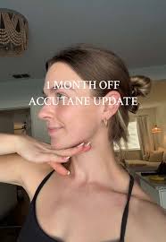 Mi experiencia positiva con Accutane