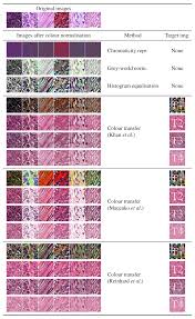 Experts say the color is best sported in the spring, but i've been know to be seen in public wearing those with a clue know you support breast cancer research. Cancers Free Full Text Experimental Assessment Of Color Deconvolution And Color Normalization For Automated Classification Of Histology Images Stained With Hematoxylin And Eosin Html