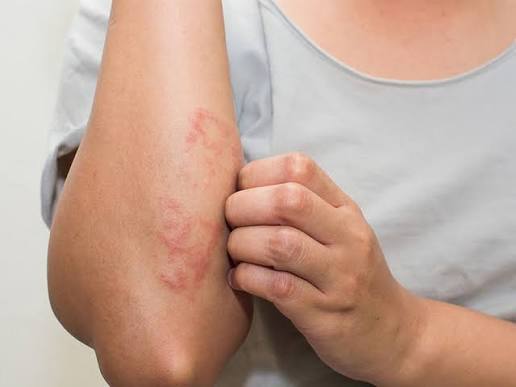 Ăn kiến có sao không? Mối nguy từ loài kiến mà bạn cần biết