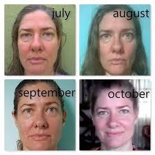 Benefits Face Yoga Face Yoga Face Yoga Method Face Yoga Exercises